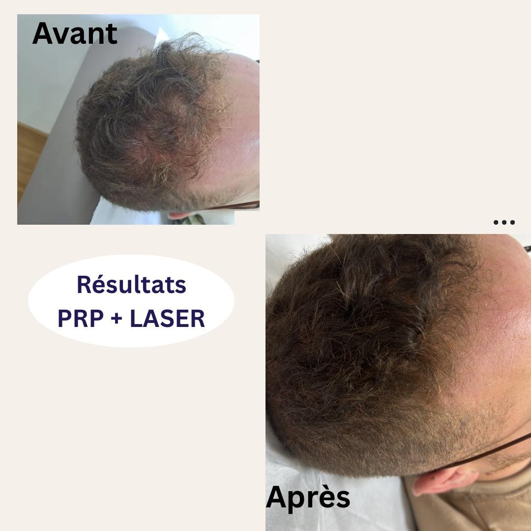 Résultat 15
